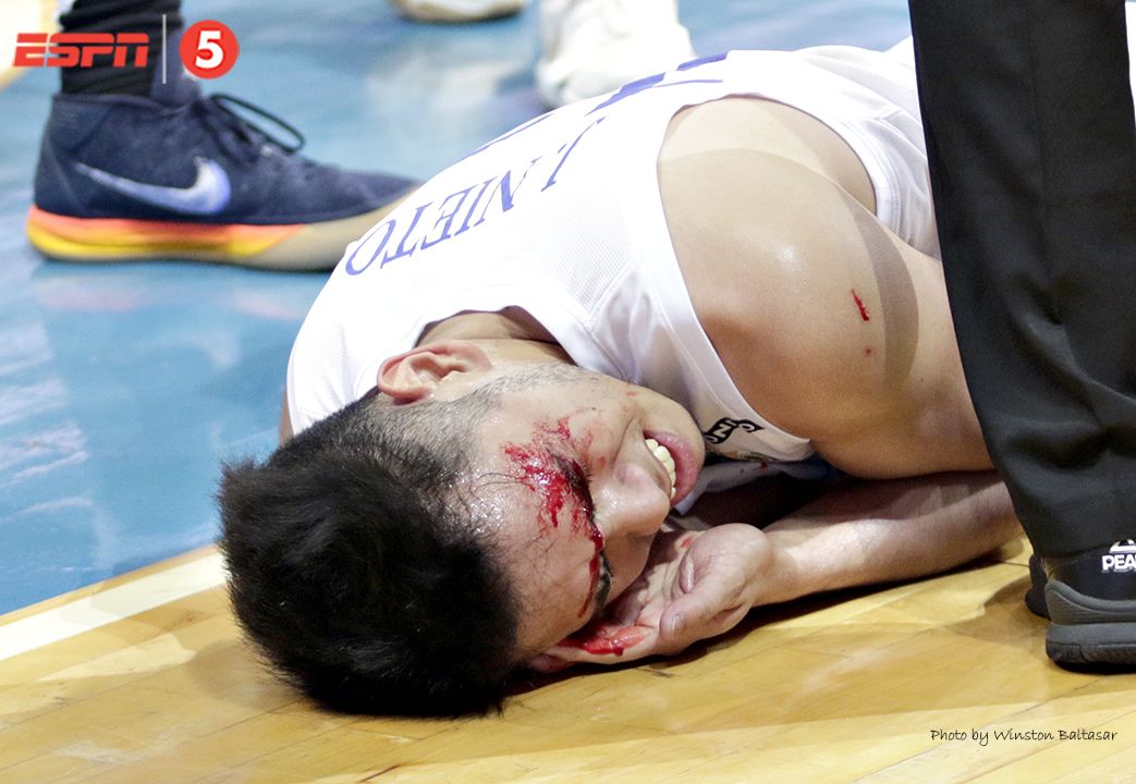 _S1A8579 Matt Nieto grimaces in pain after an elbow to the head